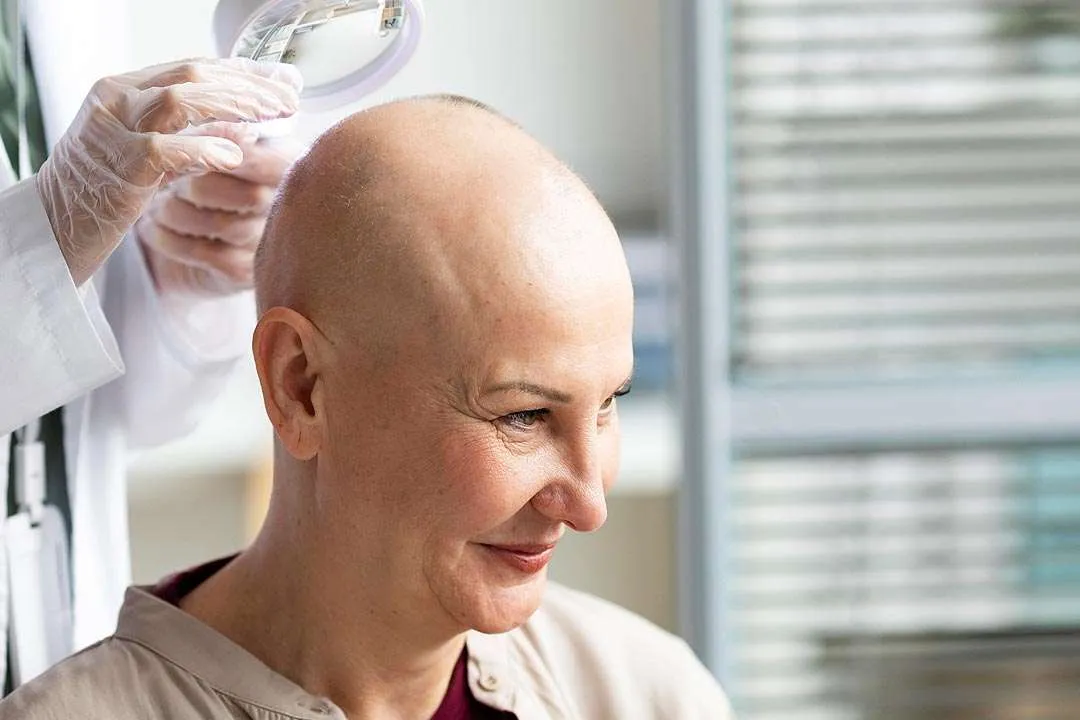 Crecimiento del cabello post quimioterapia