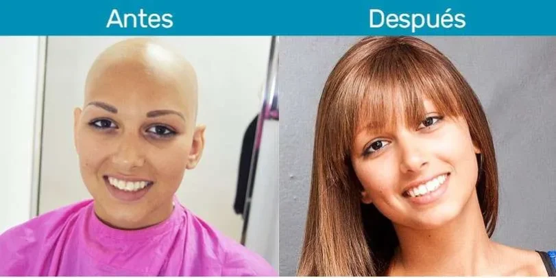 antes-despues-nohemi-web